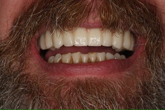 Final smile in a relaxed pose.